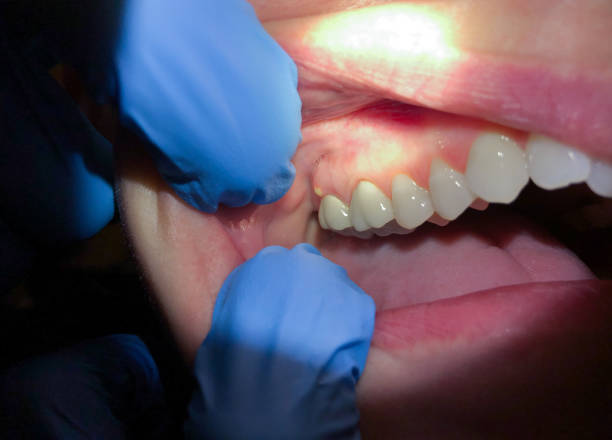 Best Emergency Treatment for Jaw Pain or Injury in Battlefield, MO