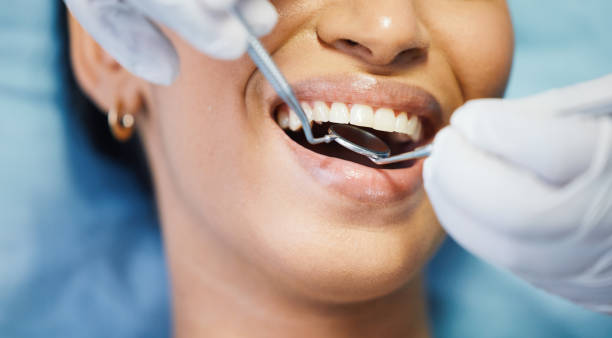 Best Emergency Cosmetic Dentistry (e.g., broken veneers) in Battlefield, MO