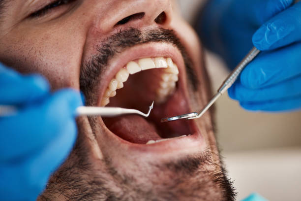 Best Broken or Chipped Tooth Repair in Battlefield, MO